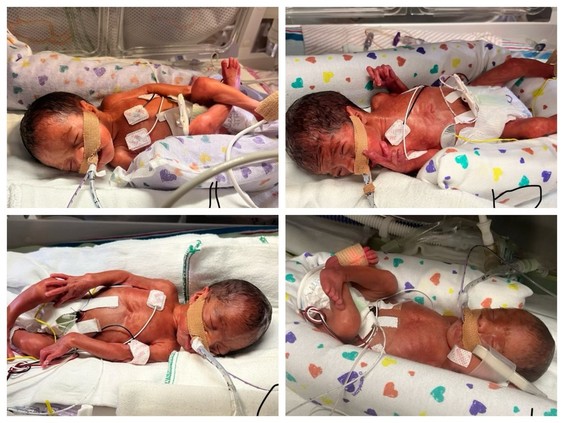 ‘Such a blessing’: Saskatchewan family welcomes quadruplets on leap year